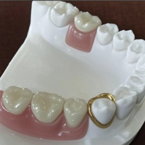 สิ่งที่แนบมาอย่างแม่นยำ